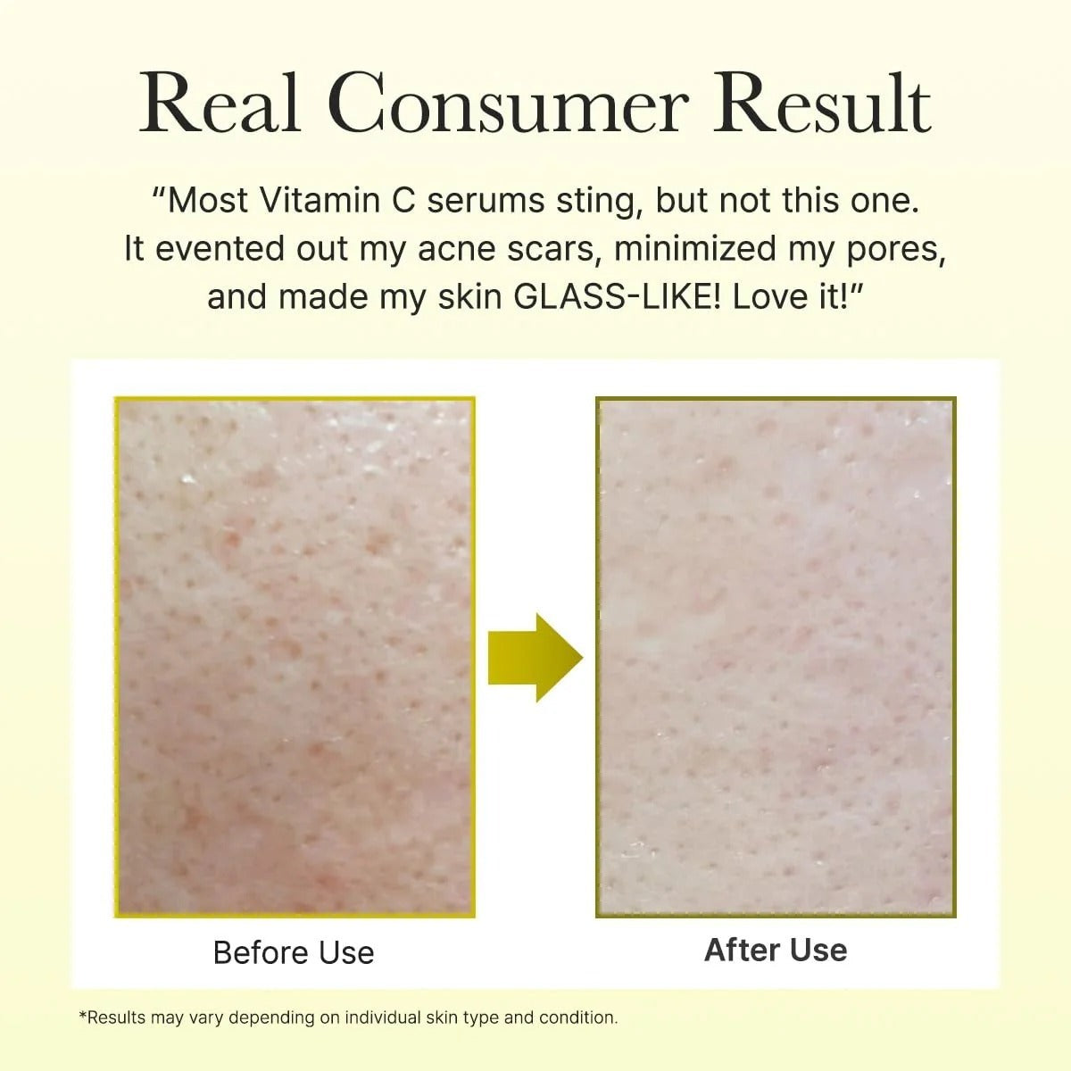 Arencia Vitamin C Booster Shot Original Serum Tube 30ml for Dark-spot care and Tightening Fine Lines, Pore, Wrinkles