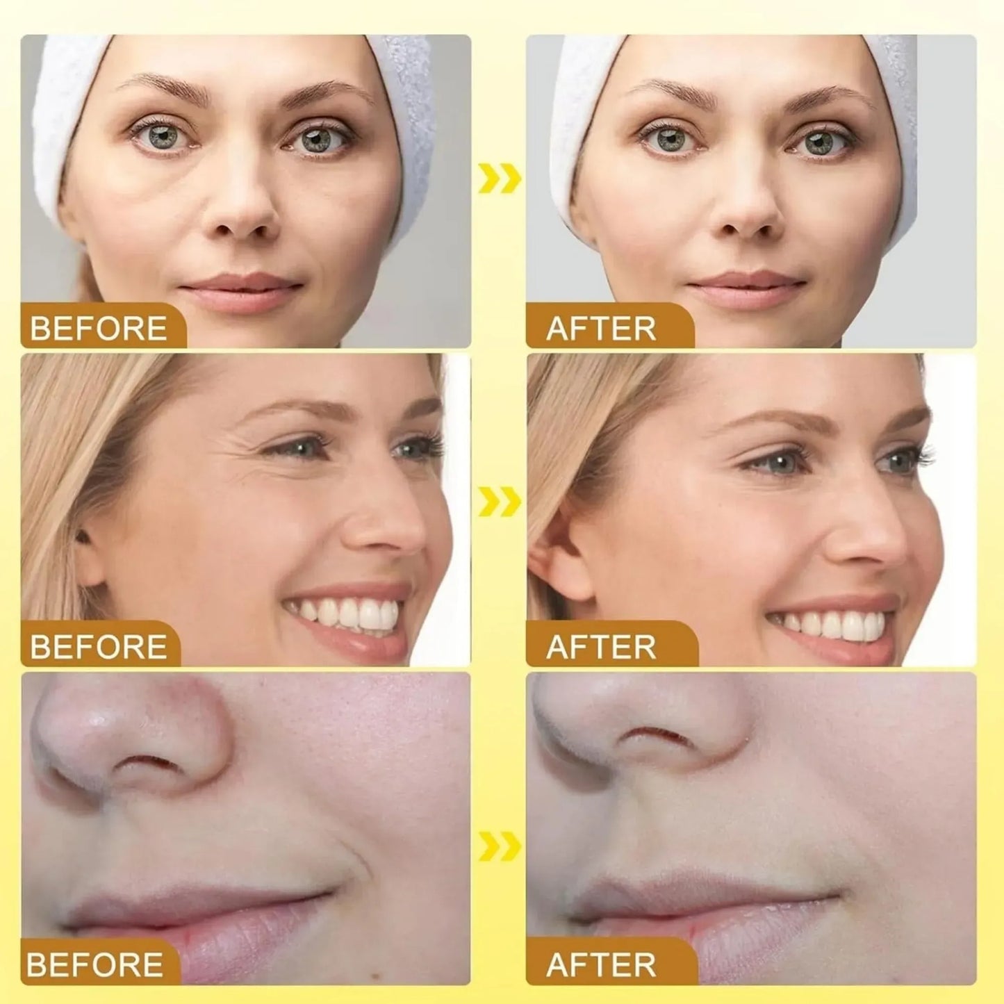 BOTOX Wrinkles Cream BEE VENOM Face Anti Aging Treatment