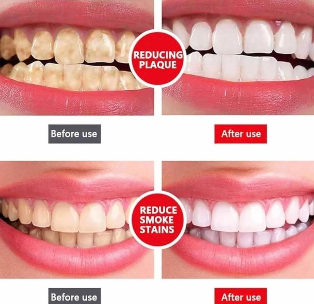 YAYASHI SP4 Toothpaste Ultra Whitening Probiotic Tooth Paste