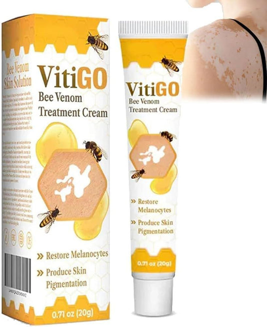 Vitiligo Cream Treatment Bee Venom Correcting Melanocytes VitiGO