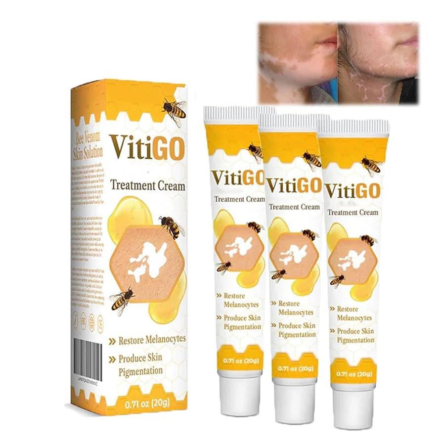 Vitiligo Cream Treatment Bee Venom Correcting Melanocytes VitiGO