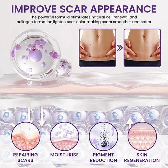 Timilk ScarVanisher Scar Gel 30g Regenscar Stem Cell